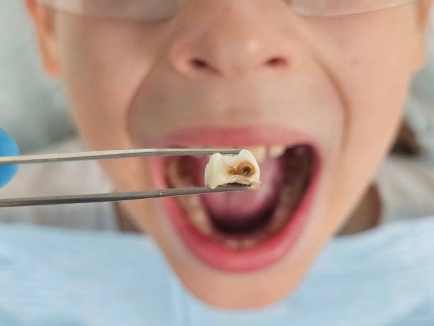 Best Emergency Dental Care for Trauma or Injury in Colonial Rk, PA